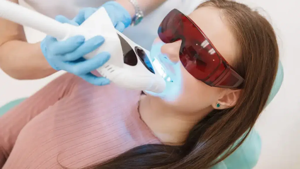 Tudo o que Você Precisa Saber Sobre Clareamento Dental: Formas e Valores Tudo o que Você Precisa Saber Sobre Clareamento Dental
